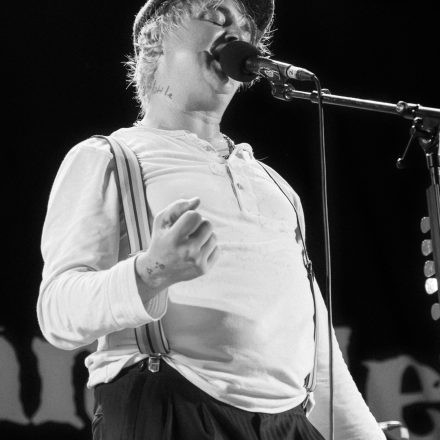 Babyshambles, Anda Morts
