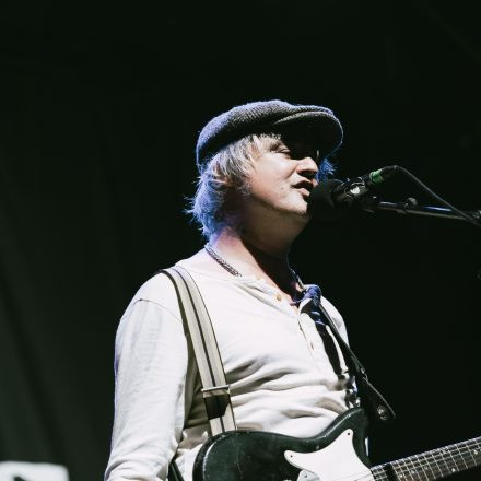 Babyshambles, Anda Morts