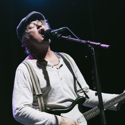 Babyshambles, Anda Morts