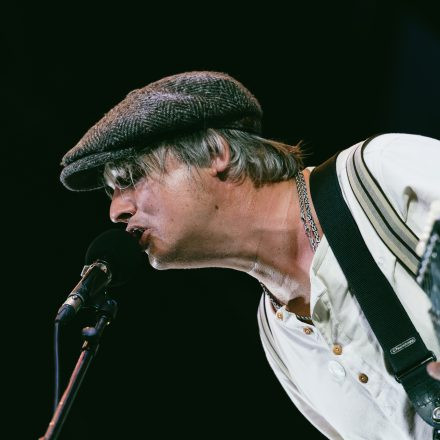 Babyshambles, Anda Morts