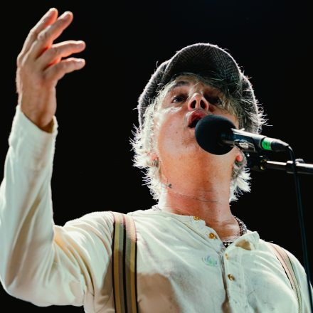 Babyshambles, Anda Morts