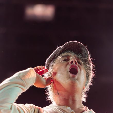 Babyshambles, Anda Morts