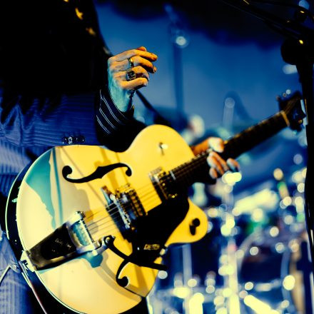 Triggerfinger