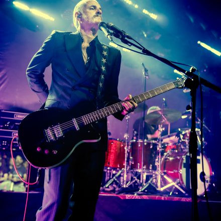 Triggerfinger