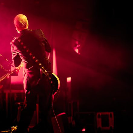 Triggerfinger