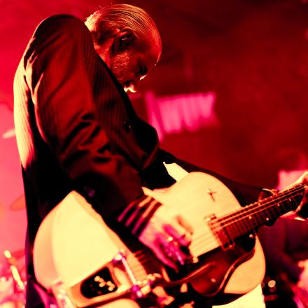Triggerfinger