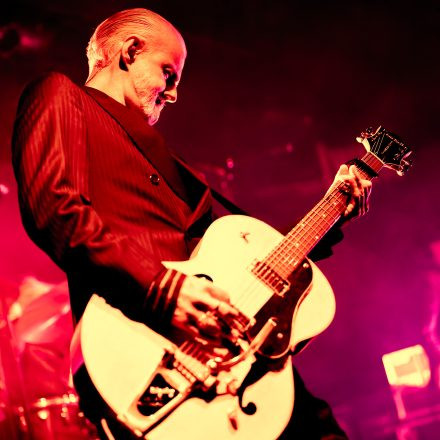 Triggerfinger