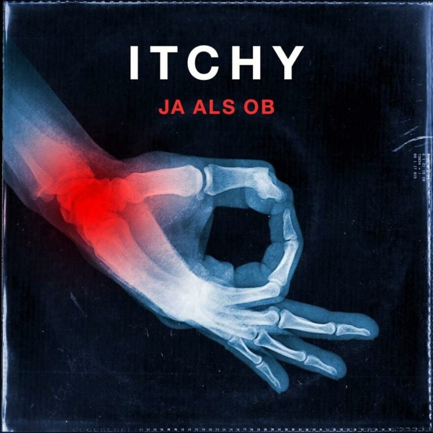 Ja als ob - Itchy